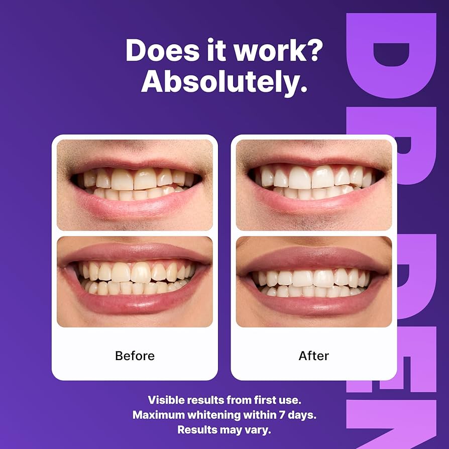 SmileLux™ — Teeth Whitening Strips
